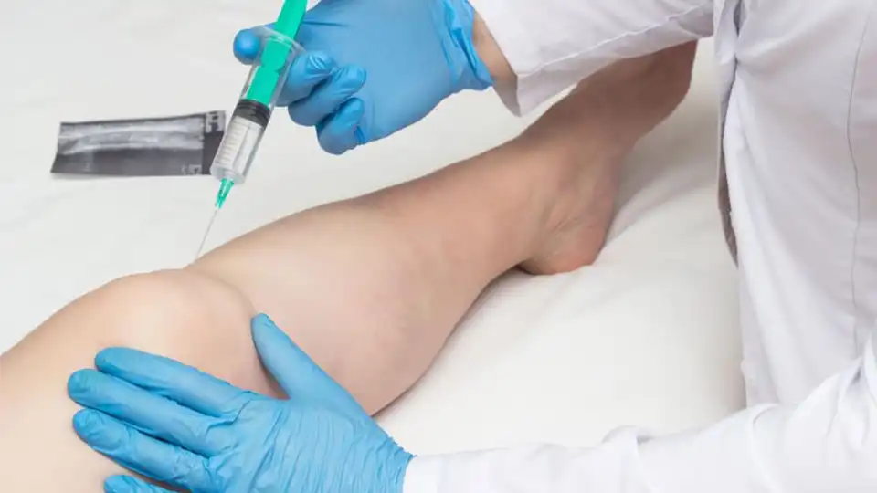 Capa do artigo O que é Ozonioterapia?
