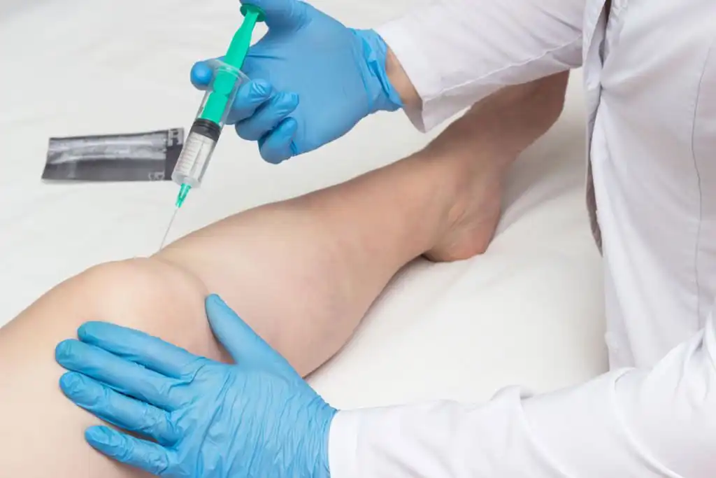 Imagem do serviço Ozonioterapia no Instituto do Bem Estar